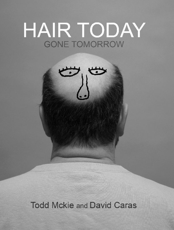 Hair Today:gone Tomorrow