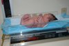 abby scale