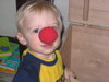 Red Nose